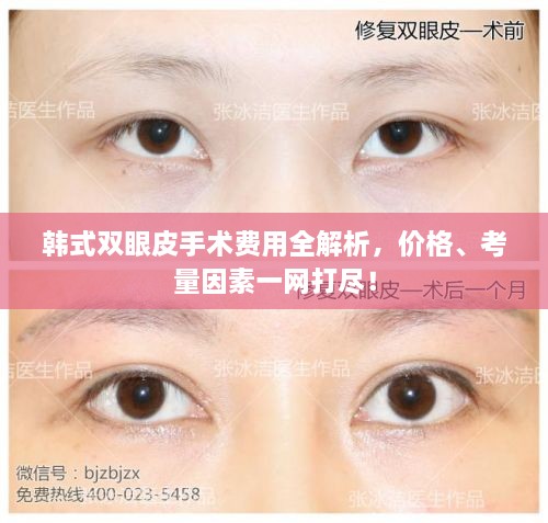 韓式雙眼皮手術(shù)費(fèi)用全解析，價(jià)格、考量因素一網(wǎng)打盡！