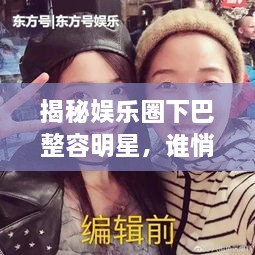揭秘娛樂圈下巴整容明星，誰悄悄整過下巴？