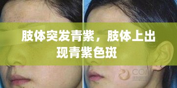 肢體突發(fā)青紫，肢體上出現(xiàn)青紫色斑 