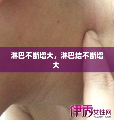 淋巴不斷增大，淋巴結不斷增大 