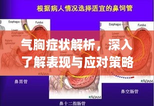 氣胸癥狀解析，深入了解表現(xiàn)與應(yīng)對策略