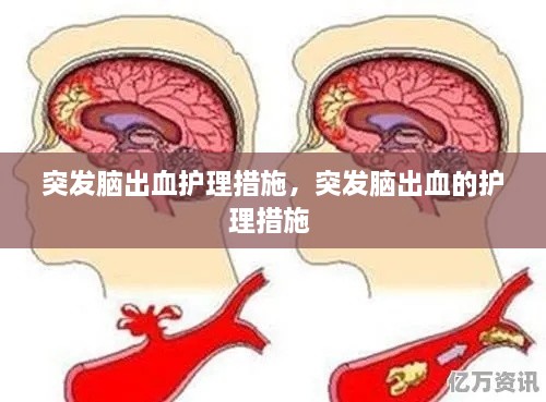 突發(fā)腦出血護(hù)理措施，突發(fā)腦出血的護(hù)理措施 