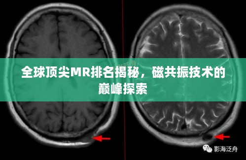 全球頂尖MR排名揭秘，磁共振技術(shù)的巔峰探索