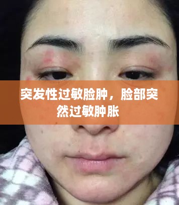 突發(fā)性過敏臉腫，臉部突然過敏腫脹 