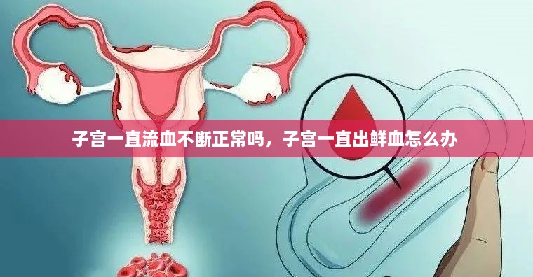 子宮一直流血不斷正常嗎，子宮一直出鮮血怎么辦 