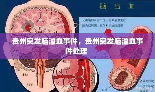 貴州突發(fā)腦溢血事件，貴州突發(fā)腦溢血事件處理 