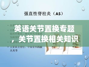英語(yǔ)關(guān)節(jié)置換專題，關(guān)節(jié)置換相關(guān)知識(shí) 