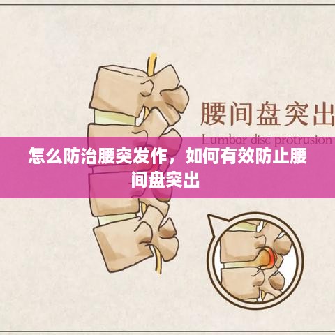 怎么防治腰突發(fā)作，如何有效防止腰間盤突出 