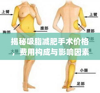 揭秘吸脂減肥手術(shù)價(jià)格，費(fèi)用構(gòu)成與影響因素全解析